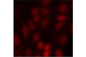 Image no. 3 for anti-Ribosomal Protein S6 Kinase, 70kDa, Polypeptide 1 (RPS6KB1) (pThr421) antibody (ABIN197014) (RPS6KB1 anticorps  (pThr421))