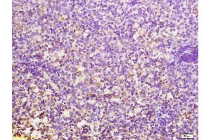 Formalin-fixed and paraffin embedded mouse lymphoma tissue labeled with Anti-CD24 Polyclonal Antibody, Unconjugated (ABIN1385707) at 1:200 followed by conjugation to the secondary antibody (CD24 anticorps  (AA 27-53))