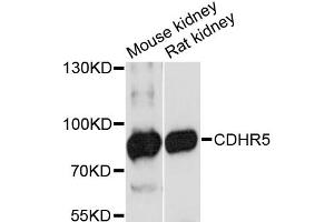Western blot analysis of extracts of various cell lines, using CDHR5 antibody (ABIN6292199) at 1:3000 dilution.