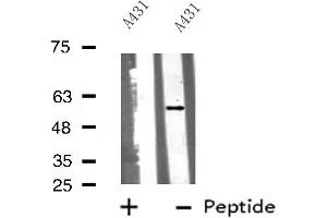 Western blot analysis of Cytochrome P450 51A1 using A431 whole cell lysates (CYP51A1 anticorps  (Internal Region))