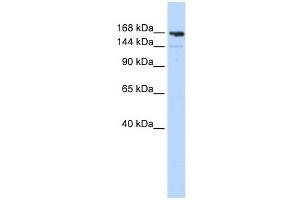 Periplakin antibody used at 1 ug/ml to detect target protein. (PPL anticorps  (Middle Region))