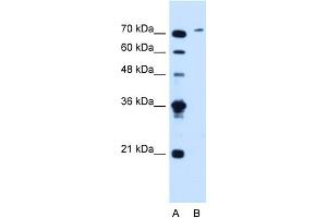 WB Suggested Anti-SLCO6A1 Antibody Titration:  1. (SLCO6A1 anticorps  (C-Term))