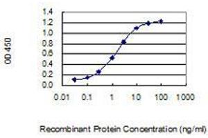 Detection limit for recombinant GST tagged MAGEA5 is 0.