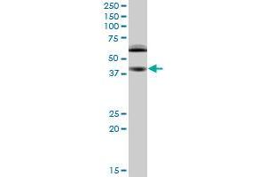 RING1 monoclonal antibody (M03), clone 2B3. (RING1 anticorps  (AA 81-170))