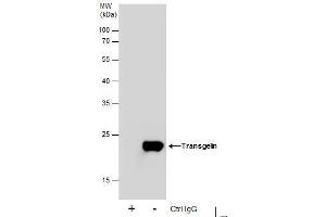 IP Image Immunoprecipitation of Transgelin protein from HeLa whole cell extracts using 5 μg of Transgelin antibody, Western blot analysis was performed using Transgelin antibody, EasyBlot anti-Rabbit IgG  was used as a secondary reagent.