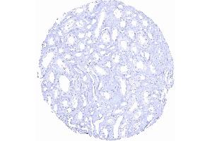 Kidney medulla (Recombinant Prostate Specific Antigen anticorps  (AA 150-250))