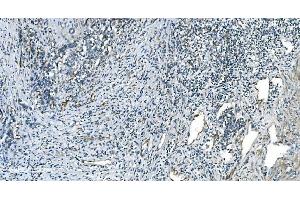 IHC analysis of H Cadherin/CDH13 using anti-H Cadherin/CDH13 antibody (ABIN7600095).