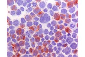 Immunohistochemistry (IHC) image for anti-ATP-Binding Cassette, Sub-Family C (CFTR/MRP), Member 10 (ABCC10) antibody (ABIN920696)