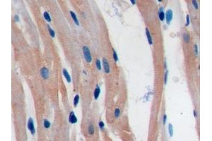 Detection of PDL1 in Rat Cardiac Muscle Tissue using Polyclonal Antibody to Programmed Cell Death Protein 1 Ligand 1 (PDL1)