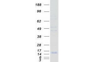Validation with Western Blot