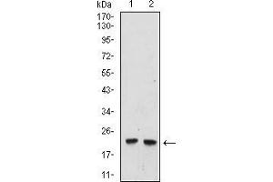 Western blot analysis using UBE2C mouse mAb against Hela (1), and Raji (2) cell lysate. (UBE2C anticorps  (AA 1-179))
