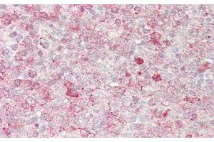 Detection of PKN1 in Human Tonsil Tissue using Polyclonal Antibody to Protein Kinase N1 (PKN1)