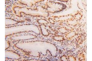 IHC-P analysis of Human Stomach Tissue, with DAB staining. (HNRNPA2B1 anticorps  (AA 21-103))