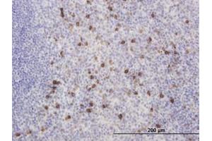 Image no. 3 for anti-Kv Channel Interacting Protein 2 (KCNIP2) (AA 1-100) antibody (ABIN466204) (KCNIP2 anticorps  (AA 1-100))