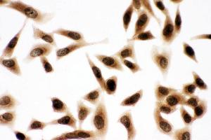 Anti-Bub3 antibody, ICC ICC: HELA Cell