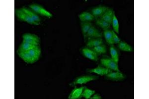 Immunofluorescent analysis of Hela cells using ABIN7169304 at dilution of 1:100 and Alexa Fluor 488-congugated AffiniPure Goat Anti-Rabbit IgG(H+L)