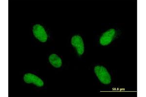 Immunofluorescence of purified MaxPab antibody to INTS12 on HepG2 cell. (INTS12 anticorps  (AA 1-462))