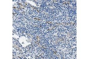 IHC analysis of CD31/PECAM1 using anti-CD31/PECAM1 antibody (ABIN7601076). (CD31 anticorps  (AA 28-382))