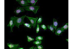 Immunofluorescence (IF) image for anti-Nuclear Receptor Subfamily 4, Group A, Member 1 (NR4A1) antibody (Alexa Fluor 594) (ABIN2656851)
