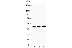 Western blot testing of TNFAIP1 antibody and Lane 1:  rat thymus;  2: HeLa;  3: COLO320;  Predicted size: 36KD;  Observed size: 36KD