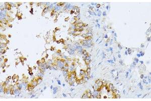 Immunohistochemistry of paraffin-embedded Rat lung using EIF2B2 Polyclonal Antibody at dilution of 1:100 (40x lens). (EIF2B2 anticorps)