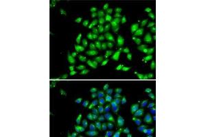 Immunofluorescence analysis of MCF7 cells using ARFGAP1 Polyclonal Antibody (ARFGAP1 anticorps)
