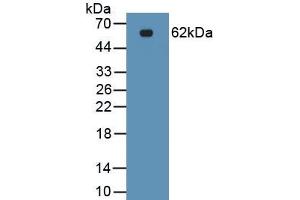 Detection of Recombinant EPCAM, Human using Polyclonal Antibody to Epithelial Cell Adhesion Molecule (EPCAM)