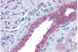 Human Kidney: Formalin-Fixed, Paraffin-Embedded (FFPE) (FAM33A anticorps  (N-Term))