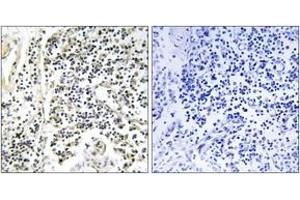 Immunohistochemistry analysis of paraffin-embedded human lymph node, using IkappaB-alpha (Phospho-Tyr305) Antibody.