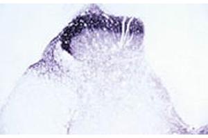 Immunohistochemical staining of Trpv2 in rat dorsal horn using Trpv2 polyclonal antibody . (TRPV2 anticorps  (AA 744-761))