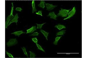 Immunofluorescence of monoclonal antibody to MR1 on HeLa cell.