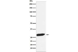 Western blot analysis of FHL1 expression in Human fetal muscle lysate.