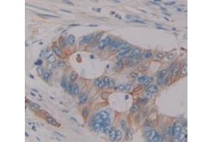 IHC-P analysis of Human Tissue, with DAB staining. (Sucrase Isomaltase anticorps  (AA 1717-1827))