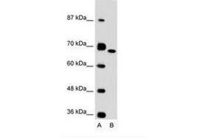 Image no. 1 for anti-Fibronectin 1 (FN1) (C-Term) antibody (ABIN6736615) (Fibronectin 1 anticorps  (C-Term))