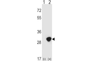 Western Blotting (WB) image for anti-Triosephosphate Isomerase 1 (TPI1) antibody (ABIN3001712) (TPI1 anticorps)