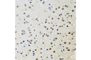 Immunohistochemistry of paraffin-embedded mouse brain using BTK antibody (ABIN3022170, ABIN3022171, ABIN3022172 and ABIN6218643) at dilution of 1:100 (40x lens). (BTK anticorps  (AA 30-240))