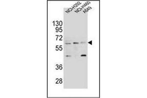 Western blot analysis of CD85h / LILRA2 Antibody (Center) in NCI-H292,NCI-H460 and A549 cell line lysates (35ug/lane).