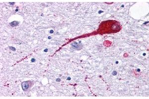 Image no. 1 for anti-Neuromedin U Receptor 2 (NMUR2) (Cytoplasmic Domain) antibody (ABIN1049107)