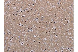 The image on the left is immunohistochemistry of paraffin-embedded Human brain tissue using ABIN7130211(MECP2 Antibody) at dilution 1/60, on the right is treated with fusion protein. (MECP2 anticorps)