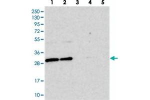 Western blot analysis of Lane 1: RT-4, Lane 2: U-251 MG, Lane 3: Human Plasma, Lane 4: Liver, Lane 5: Tonsil with BCDIN3D polyclonal antibody  at 1:250-1:500 dilution. (BCDIN3D anticorps)