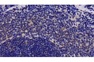 Detection of IL1R1 in Rat Spleen Tissue using Polyclonal Antibody to Interleukin 1 Receptor Type I (IL1R1) (IL1R1 anticorps  (AA 226-352))