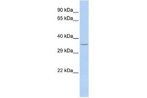 SPDYA antibody used at 1 ug/ml to detect target protein. (SPDYA anticorps)