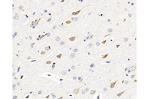 Immunohistochemistry analysis of paraffin-embedded rat brain using GRIN2B Polyclonal Antibody at dilution of 1:200. (GRIN2B anticorps)