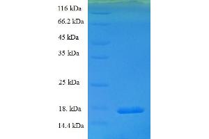 SDS-PAGE (SDS) image for Potassium Voltage-Gated Channel, Isk-Related Family, Member 2 (KCNE2) (AA 1-123), (full length) protein (His tag) (ABIN5709791)