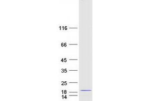 Validation with Western Blot