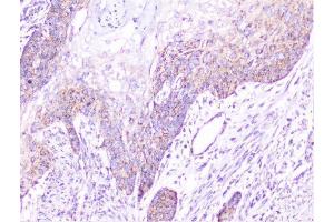 IHC analysis of cortactin using anti-cortactin antibody (ABIN6719306). (Cortactin anticorps  (AA 1-105))