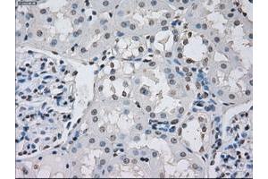 Image no. 1 for anti-Protein Phosphatase 5, Catalytic Subunit (PPP5C) antibody (ABIN1500390)