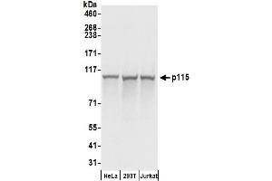 Western Blotting (WB) image for anti-rho GTPase Activating Protein 4 (ARHGAP4) (AA 912-962) antibody (ABIN7455040) (ARHGAP4 anticorps  (AA 912-962))