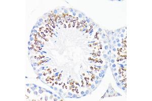 Immunohistochemistry of paraffin-embedded mouse testis using CAMP antibody (ABIN3022305, ABIN3022306, ABIN3022307, ABIN1512664 and ABIN6218724) at dilution of 1:200 (40x lens).