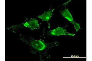 Immunofluorescence of monoclonal antibody to GOLM1 on HeLa cell.
